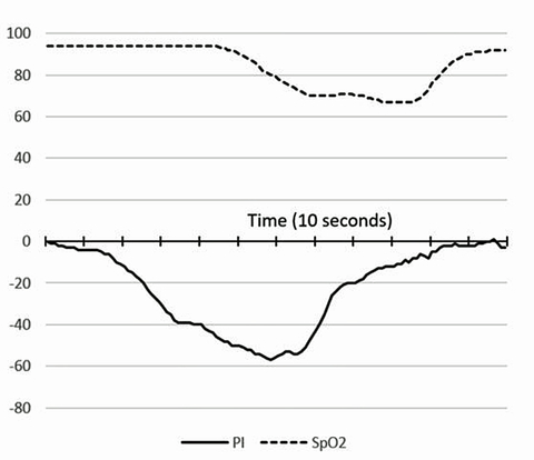 Sensors Insights 3 2017-09-08 Fig3 PI Response to briefly breathing nitrogen.